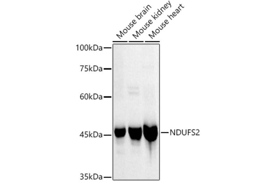 Western Blot - Anti-NDUFS2 Antibody [ARC3018] (A309418) - Antibodies.com