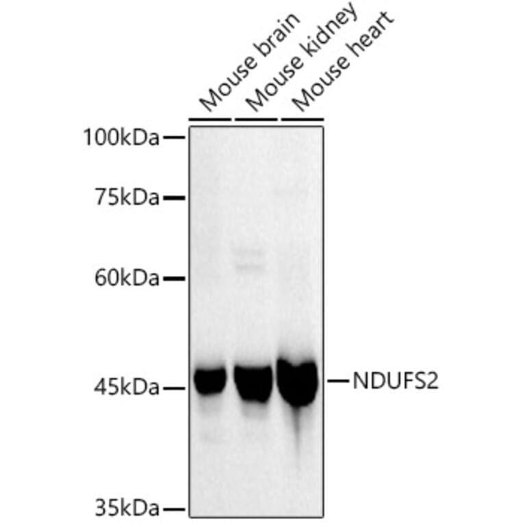 Western Blot - Anti-NDUFS2 Antibody [ARC3018] (A309418) - Antibodies.com