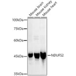 Western Blot - Anti-NDUFS2 Antibody [ARC3018] (A309418) - Antibodies.com