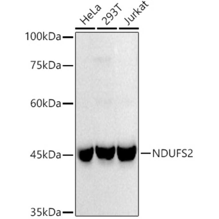 Western Blot - Anti-NDUFS2 Antibody [ARC3018] (A309418) - Antibodies.com