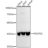 Western Blot - Anti-NDUFS2 Antibody [ARC3018] (A309418) - Antibodies.com