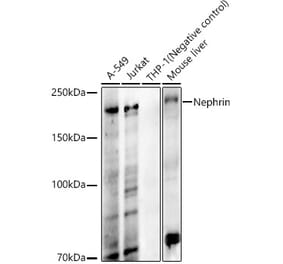 Western Blot - Anti-Nephrin Antibody [ARC59568] (A309419) - Antibodies.com