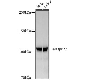 Western Blot - Anti-Nesprin3 Antibody [ARC3013] (A309420) - Antibodies.com