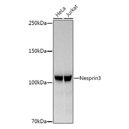 Western Blot - Anti-Nesprin3 Antibody [ARC3013] (A309420) - Antibodies.com