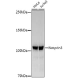 Western Blot - Anti-Nesprin3 Antibody [ARC3013] (A309420) - Antibodies.com