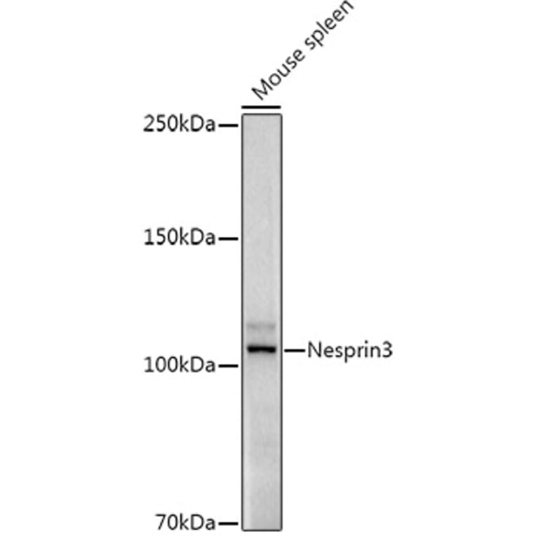Western Blot - Anti-Nesprin3 Antibody [ARC3013] (A309420) - Antibodies.com