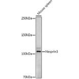 Western Blot - Anti-Nesprin3 Antibody [ARC3013] (A309420) - Antibodies.com