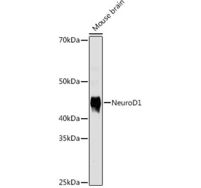 Western Blot - Anti-NeuroD1 Antibody [ARC0483] (A309422) - Antibodies.com
