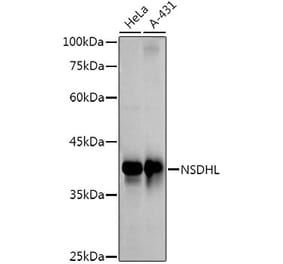 Western Blot - Anti-NSDHL Antibody [ARC3040] (A309428) - Antibodies.com
