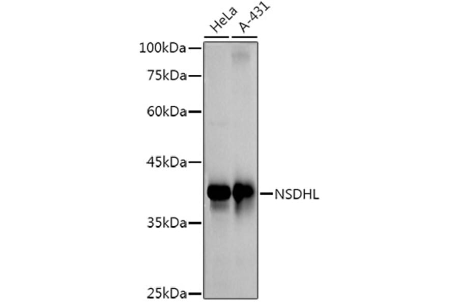 Western Blot - Anti-NSDHL Antibody [ARC3040] (A309428) - Antibodies.com
