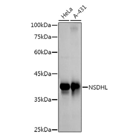 Western Blot - Anti-NSDHL Antibody [ARC3040] (A309428) - Antibodies.com