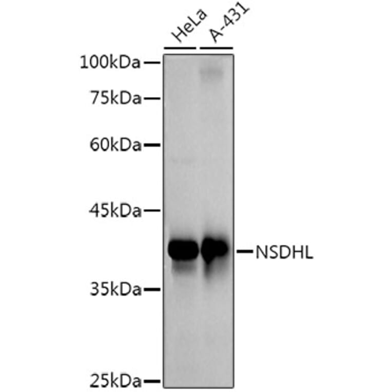 Western Blot - Anti-NSDHL Antibody [ARC3040] (A309428) - Antibodies.com