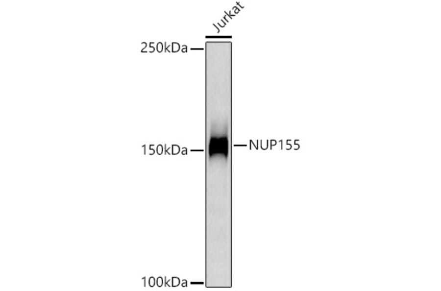 Western Blot - Anti-NUP155 Antibody [ARC3030] (A309430) - Antibodies.com
