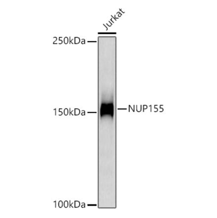 Western Blot - Anti-NUP155 Antibody [ARC3030] (A309430) - Antibodies.com