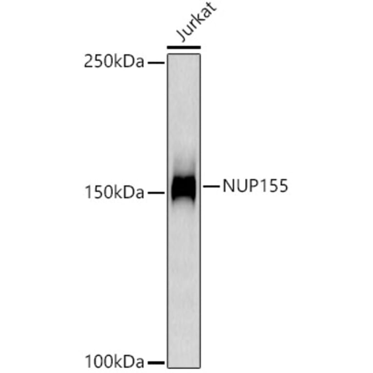 Western Blot - Anti-NUP155 Antibody [ARC3030] (A309430) - Antibodies.com