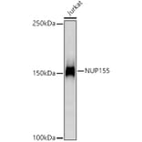 Western Blot - Anti-NUP155 Antibody [ARC3030] (A309430) - Antibodies.com