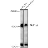 Western Blot - Anti-NUP155 Antibody [ARC3030] (A309430) - Antibodies.com