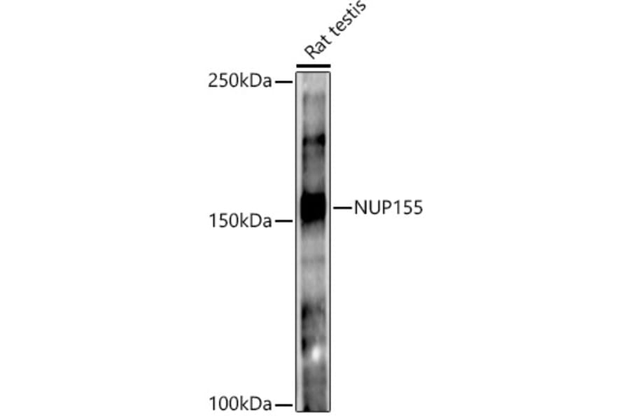 Western Blot - Anti-NUP155 Antibody [ARC3030] (A309430) - Antibodies.com