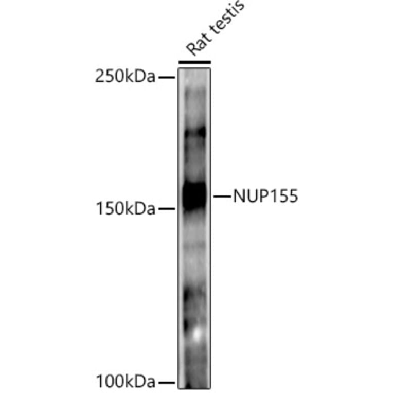 Western Blot - Anti-NUP155 Antibody [ARC3030] (A309430) - Antibodies.com