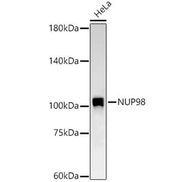 Western Blot - Anti-NUP98 Antibody [ARC58955] (A309431) - Antibodies.com