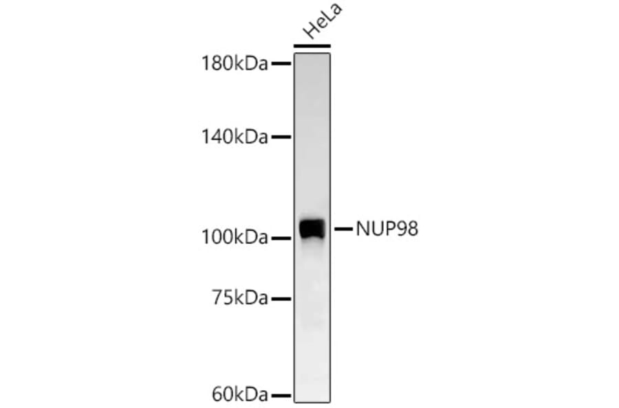 Western Blot - Anti-NUP98 Antibody [ARC58955] (A309431) - Antibodies.com