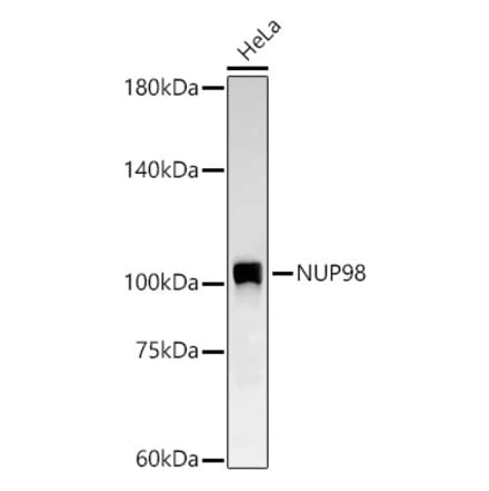 Western Blot - Anti-NUP98 Antibody [ARC58955] (A309431) - Antibodies.com