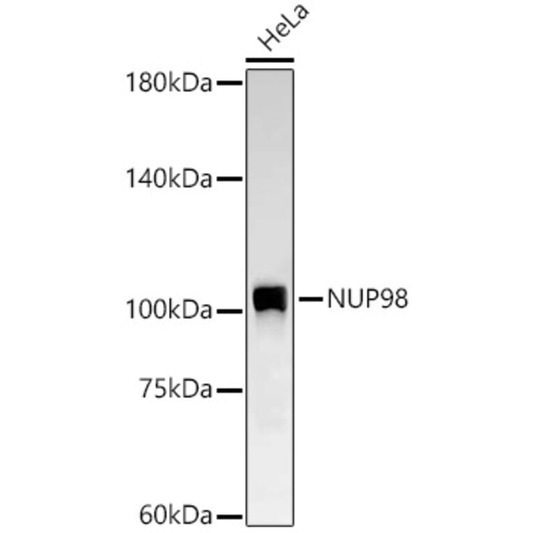 Western Blot - Anti-NUP98 Antibody [ARC58955] (A309431) - Antibodies.com