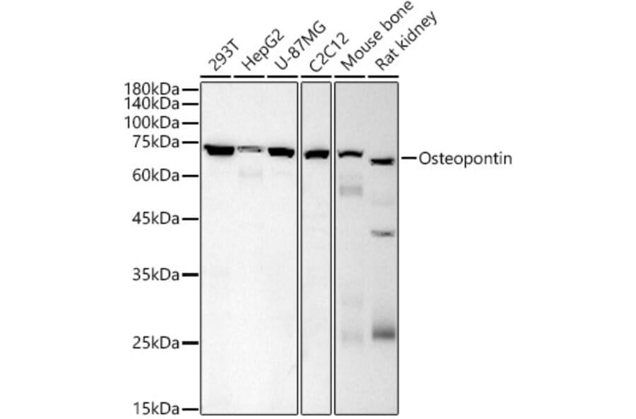 Western Blot - Anti-Osteopontin Antibody [AMC0443] (A309432) - Antibodies.com