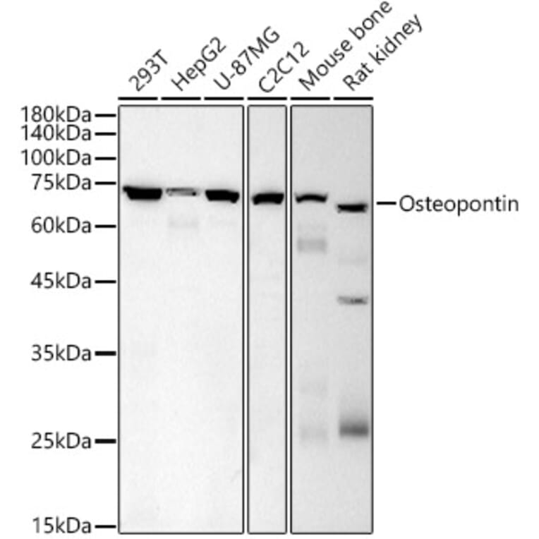 Western Blot - Anti-Osteopontin Antibody [AMC0443] (A309432) - Antibodies.com