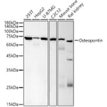 Western Blot - Anti-Osteopontin Antibody [AMC0443] (A309432) - Antibodies.com