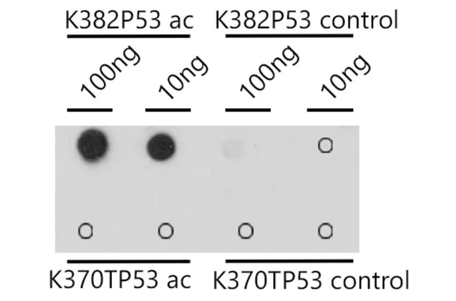 Dot Blot - Anti-p53 (acetyl Lys382) Antibody (A309434) - Antibodies.com