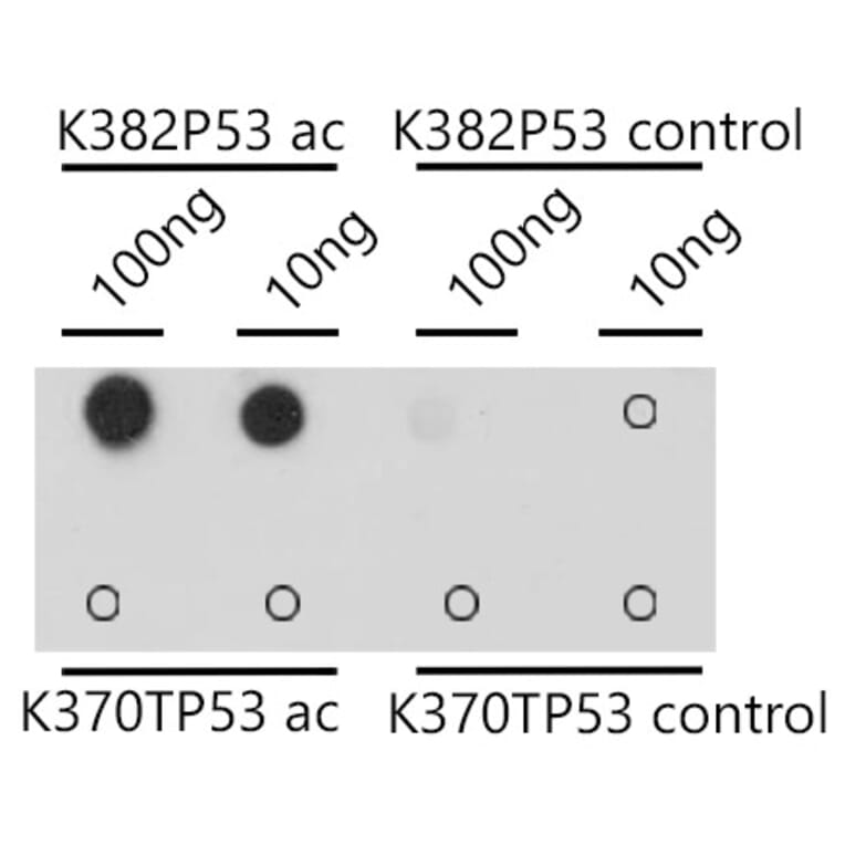 Dot Blot - Anti-p53 (acetyl Lys382) Antibody (A309434) - Antibodies.com
