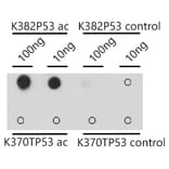 Dot Blot - Anti-p53 (acetyl Lys382) Antibody (A309434) - Antibodies.com