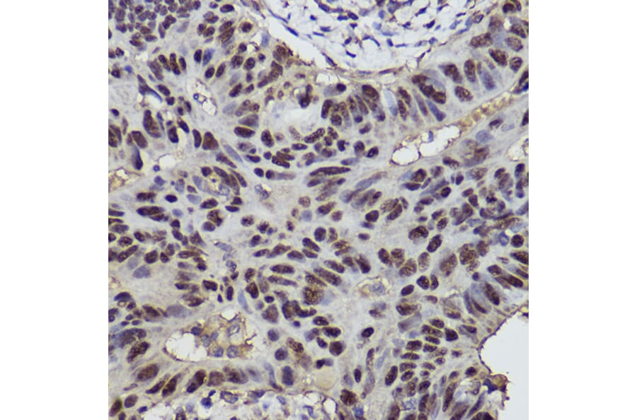 Immunohistochemistry - Anti-p53 Antibody (A309435) - Antibodies.com