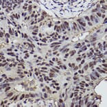 Immunohistochemistry - Anti-p53 Antibody (A309435) - Antibodies.com