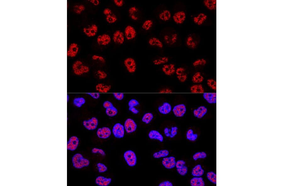 Immunofluorescence - Anti-p53 Antibody (A309435) - Antibodies.com