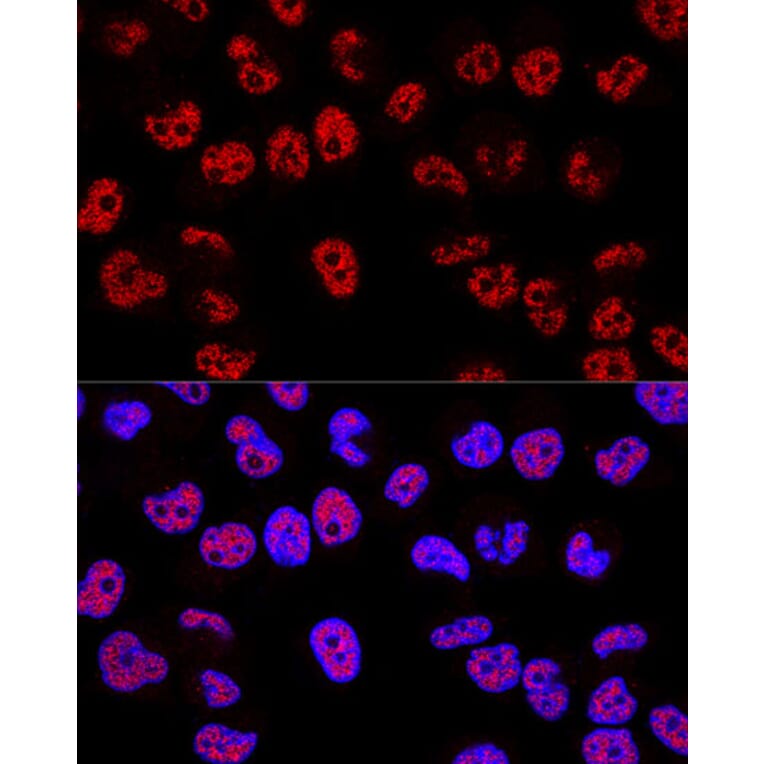 Immunofluorescence - Anti-p53 Antibody (A309435) - Antibodies.com