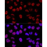 Immunofluorescence - Anti-p53 Antibody (A309435) - Antibodies.com