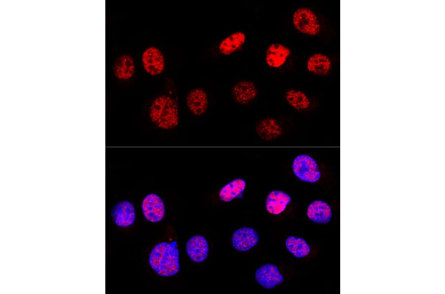 Immunofluorescence - Anti-p53 Antibody (A309435) - Antibodies.com