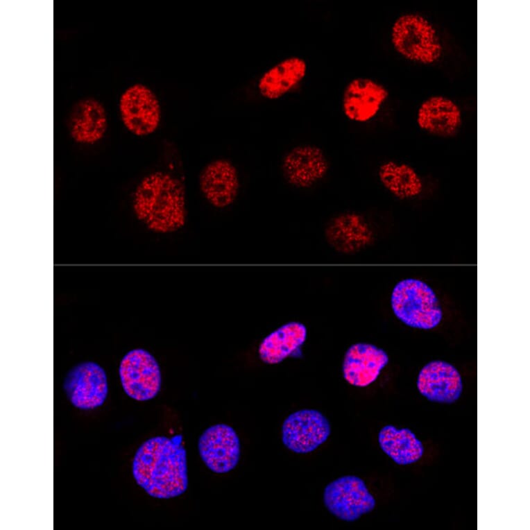 Immunofluorescence - Anti-p53 Antibody (A309435) - Antibodies.com