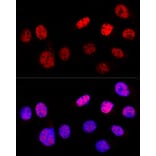 Immunofluorescence - Anti-p53 Antibody (A309435) - Antibodies.com