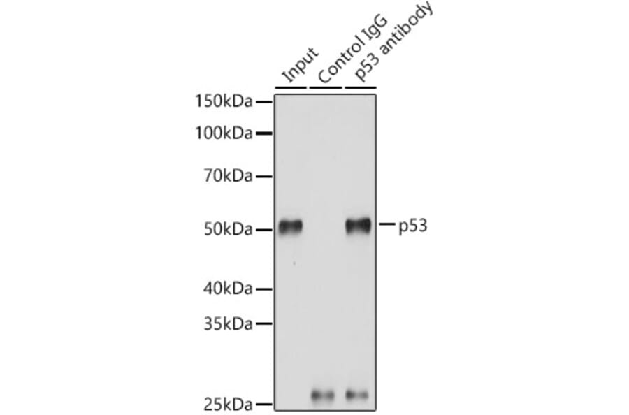 Western Blot - Anti-p53 Antibody (A309435) - Antibodies.com