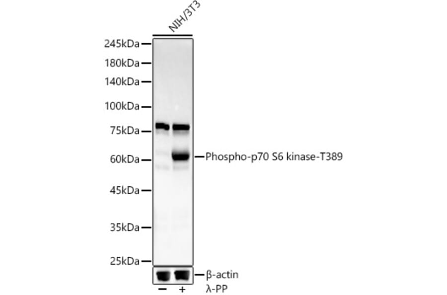 Western Blot - Anti-S6K1 (phospho Thr389) Antibody [ARC55792] (A309436) - Antibodies.com