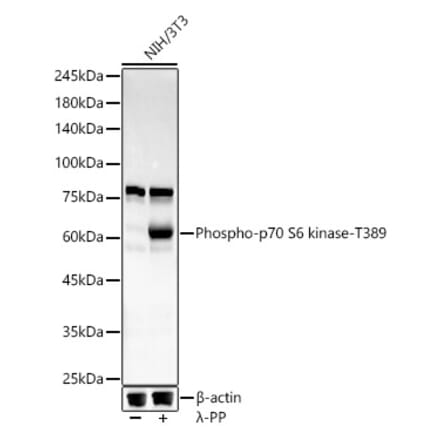 Western Blot - Anti-S6K1 (phospho Thr389) Antibody [ARC55792] (A309436) - Antibodies.com