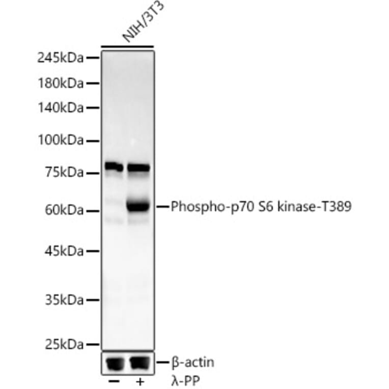 Western Blot - Anti-S6K1 (phospho Thr389) Antibody [ARC55792] (A309436) - Antibodies.com