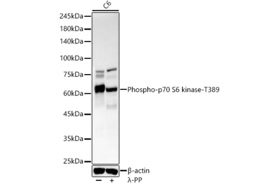 Western Blot - Anti-S6K1 (phospho Thr389) Antibody [ARC55792] (A309436) - Antibodies.com