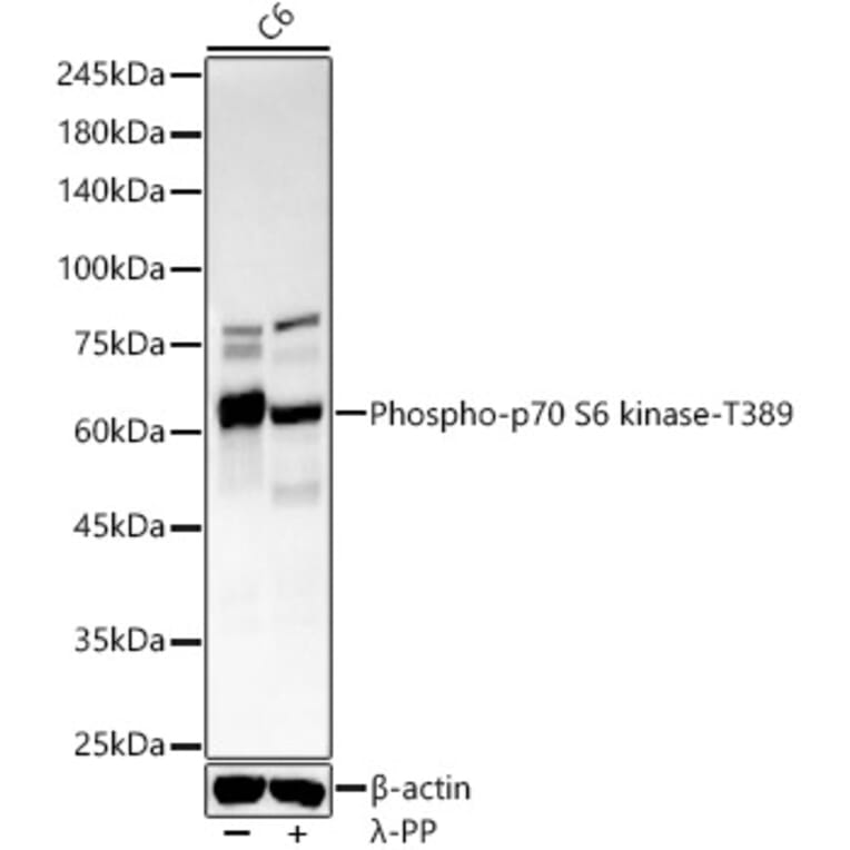 Western Blot - Anti-S6K1 (phospho Thr389) Antibody [ARC55792] (A309436) - Antibodies.com