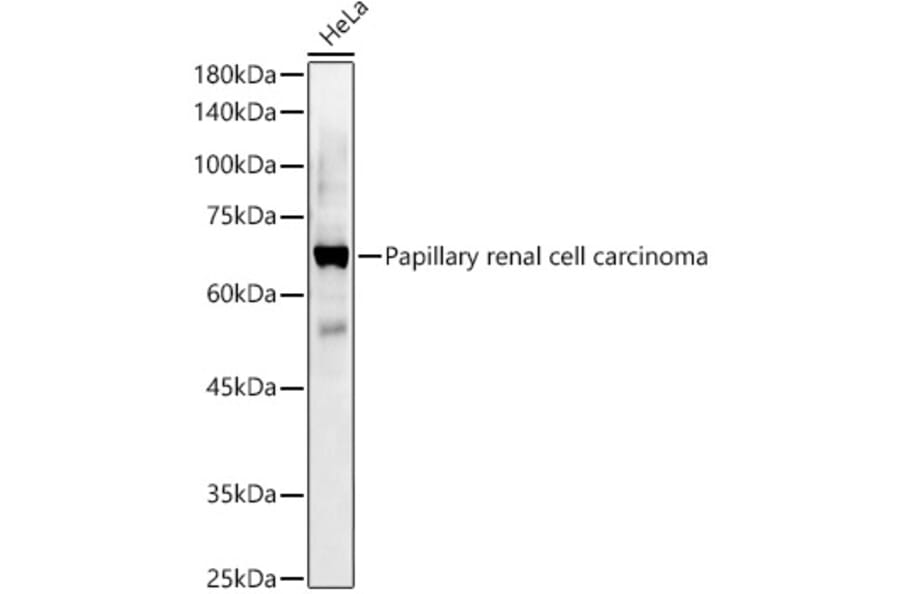Western Blot - Anti-Papillary renal cell carcinoma Antibody (A309437) - Antibodies.com