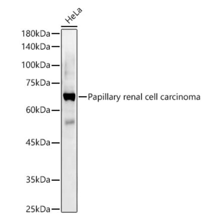 Western Blot - Anti-Papillary renal cell carcinoma Antibody (A309437) - Antibodies.com