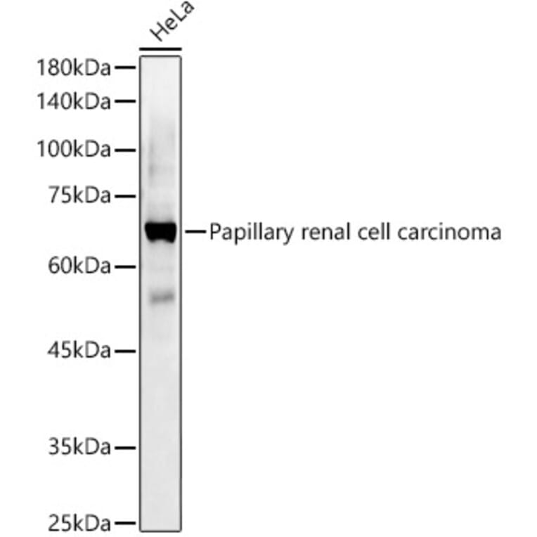 Western Blot - Anti-Papillary renal cell carcinoma Antibody (A309437) - Antibodies.com